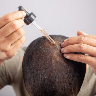 Minoxidil: como usar, vantagens e desvantagens